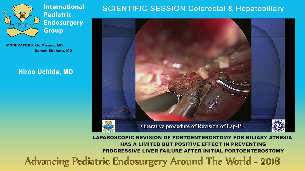 LAPAROSCOPIC REVISION OF PORTOENTEROSTOMY FOR ...